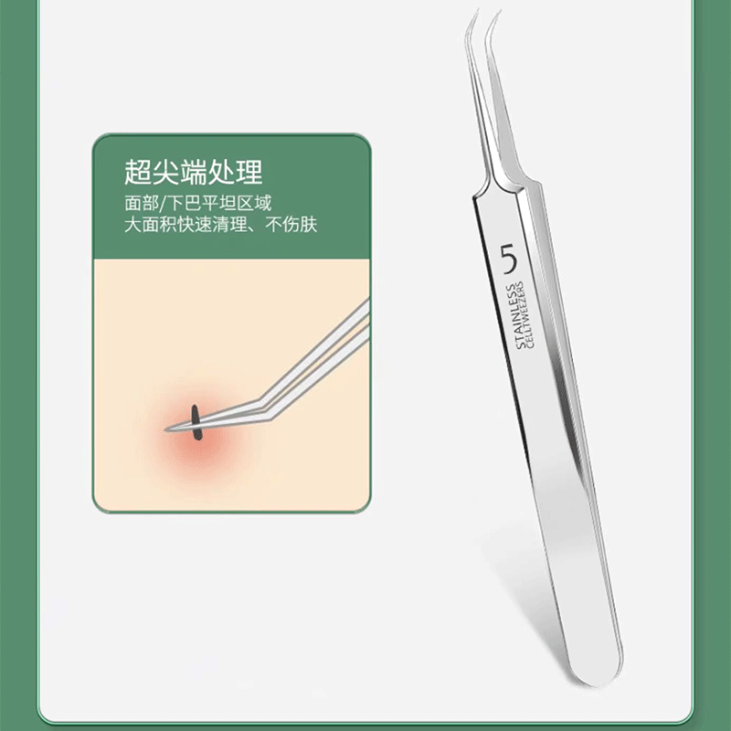 Professional Acne & Blackhead Removal Tool Set — Precision Tweezers & Extractor Kit